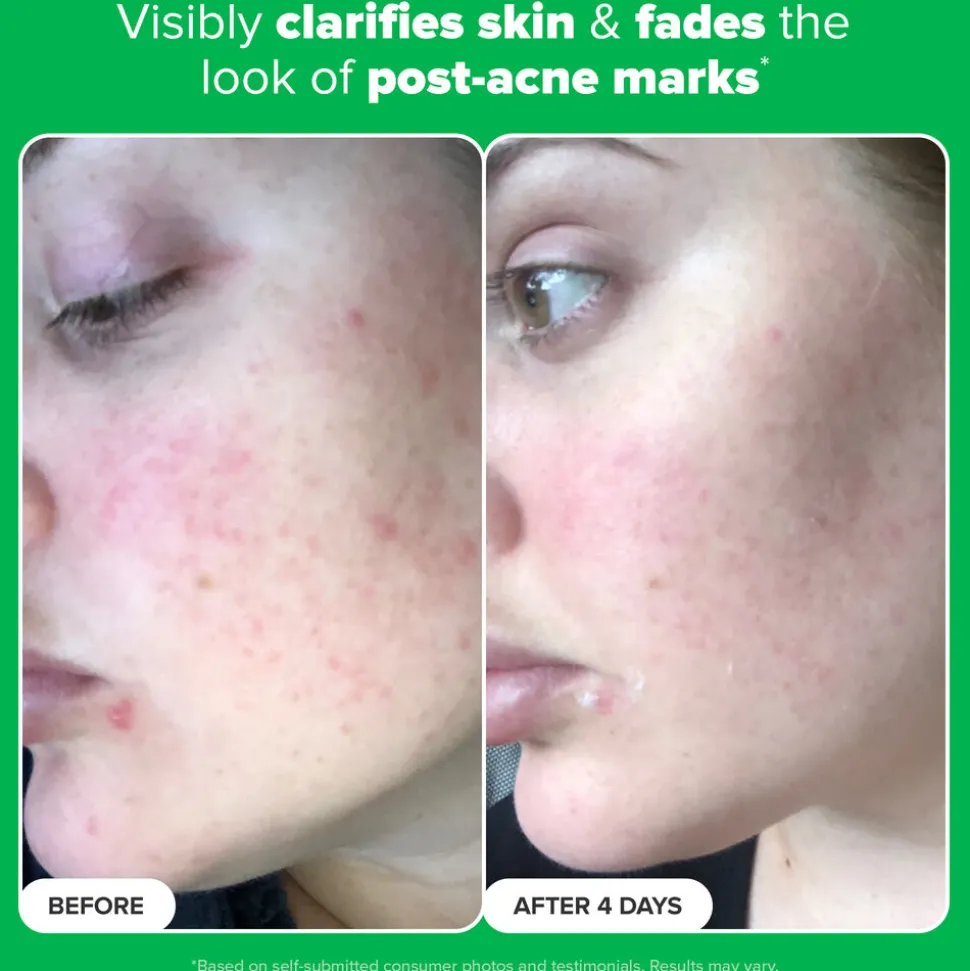 10% Azelaic Acid Booster 30ML