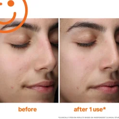 5 Minute Facial-Sensitive Skin Set