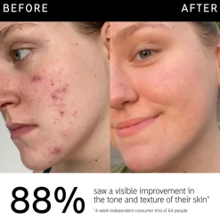 15% Vitamin C + EGF Serum 30ML