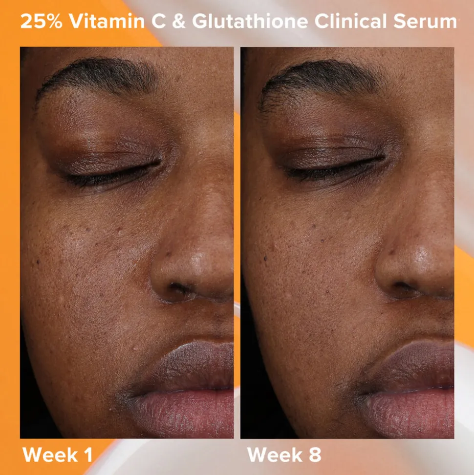 25% Vitamin C + Glutathione Clinical Serum 30ML