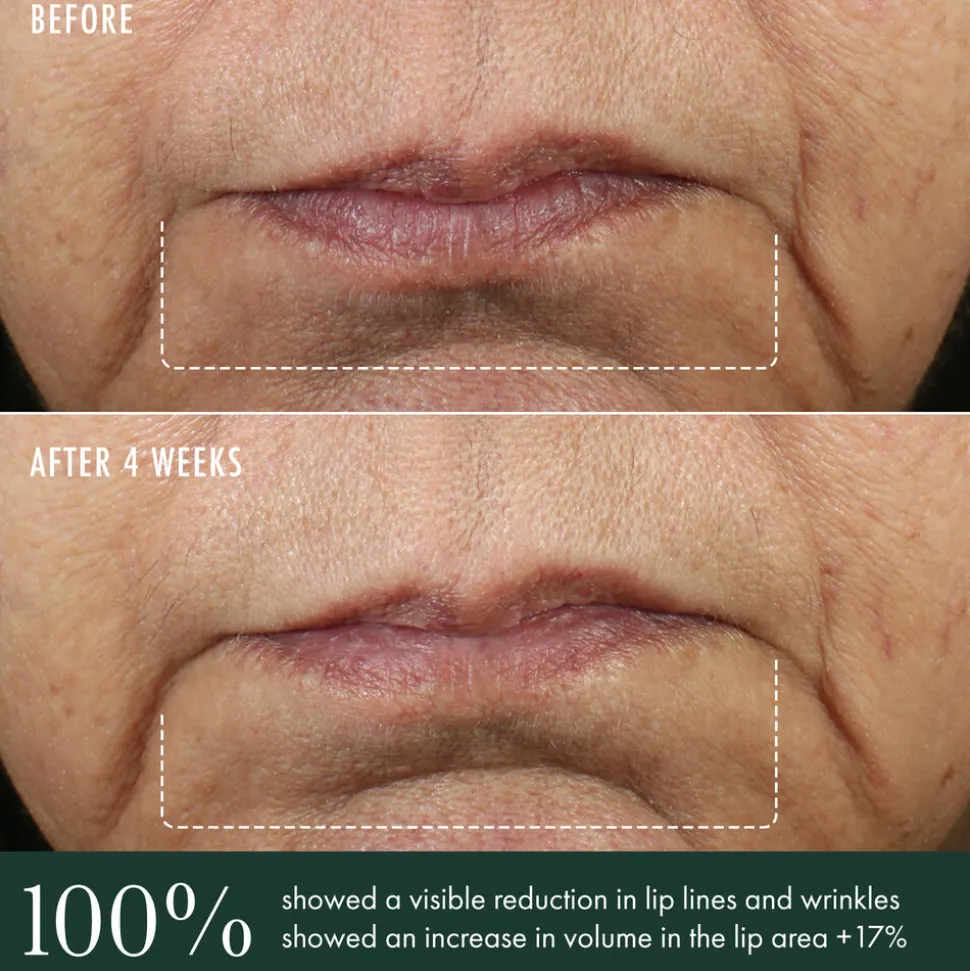 Advanced Lip Perioral Serum 15ML