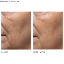 Alpha Beta Daily Moisturizer