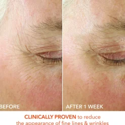 Alpha Beta Ultra Gentle Daily Peel