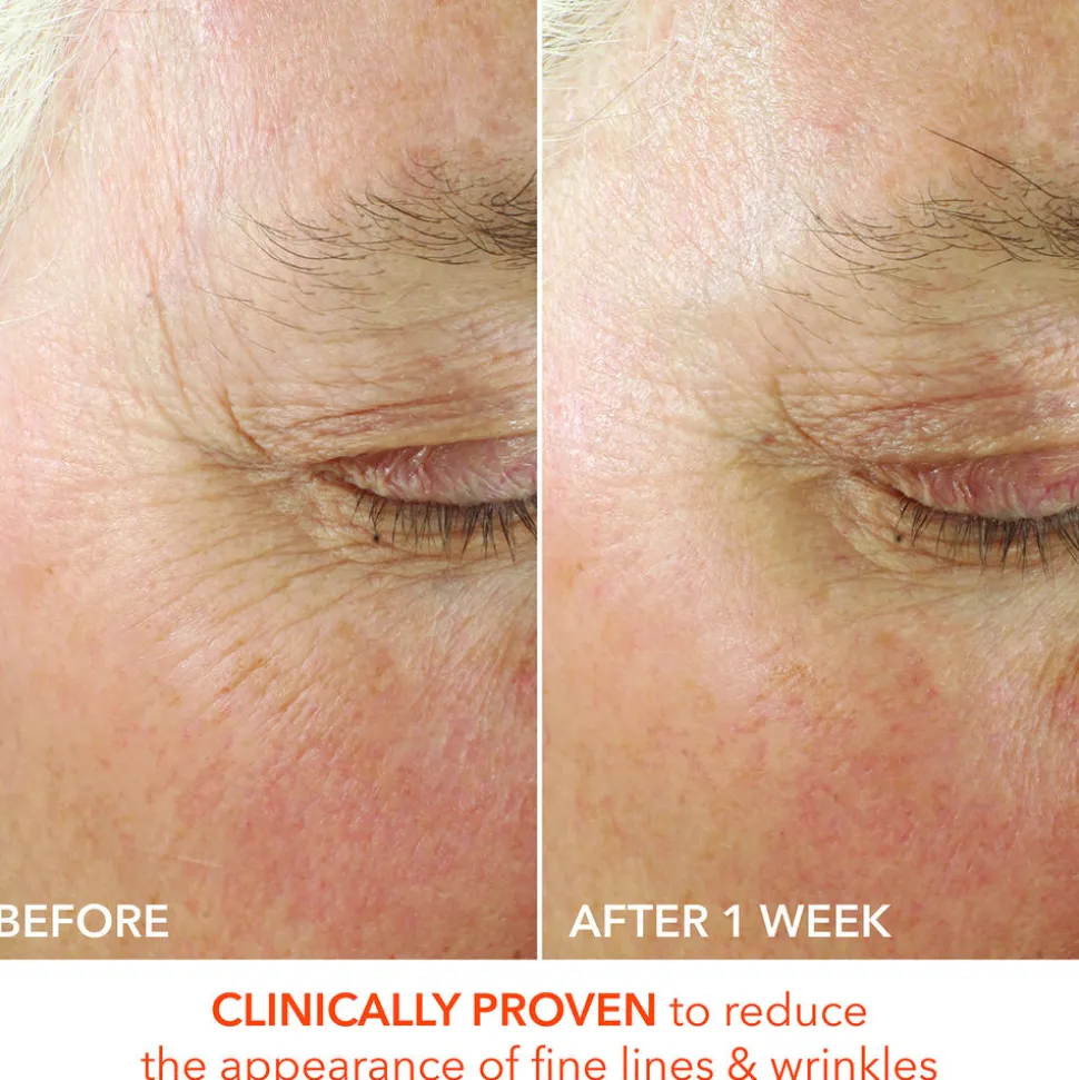 Alpha Beta Ultra Gentle Daily Peel