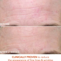 Alpha Beta Ultra Gentle Daily Peel