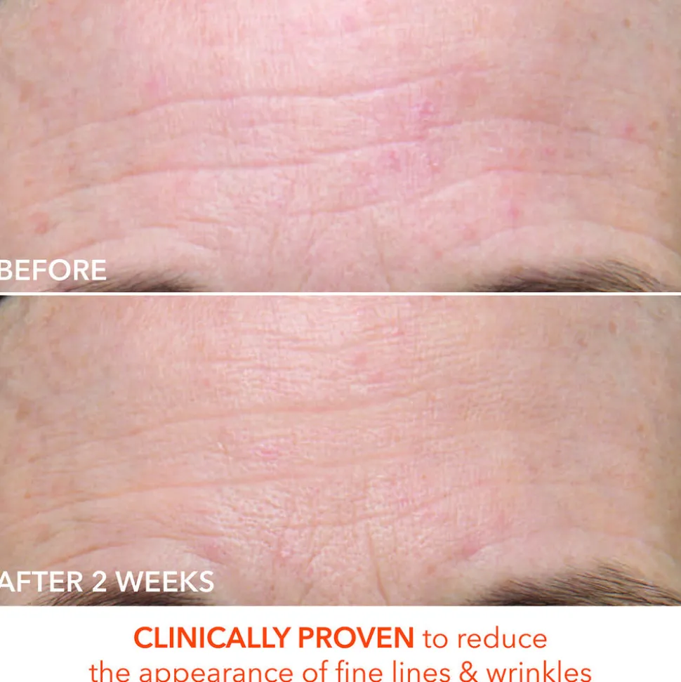Alpha Beta Ultra Gentle Daily Peel