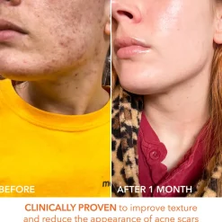 Alpha Beta Universal Daily Peel