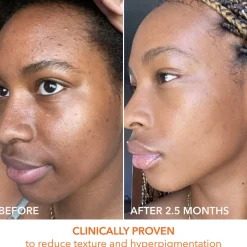Alpha Beta Universal Daily Peel