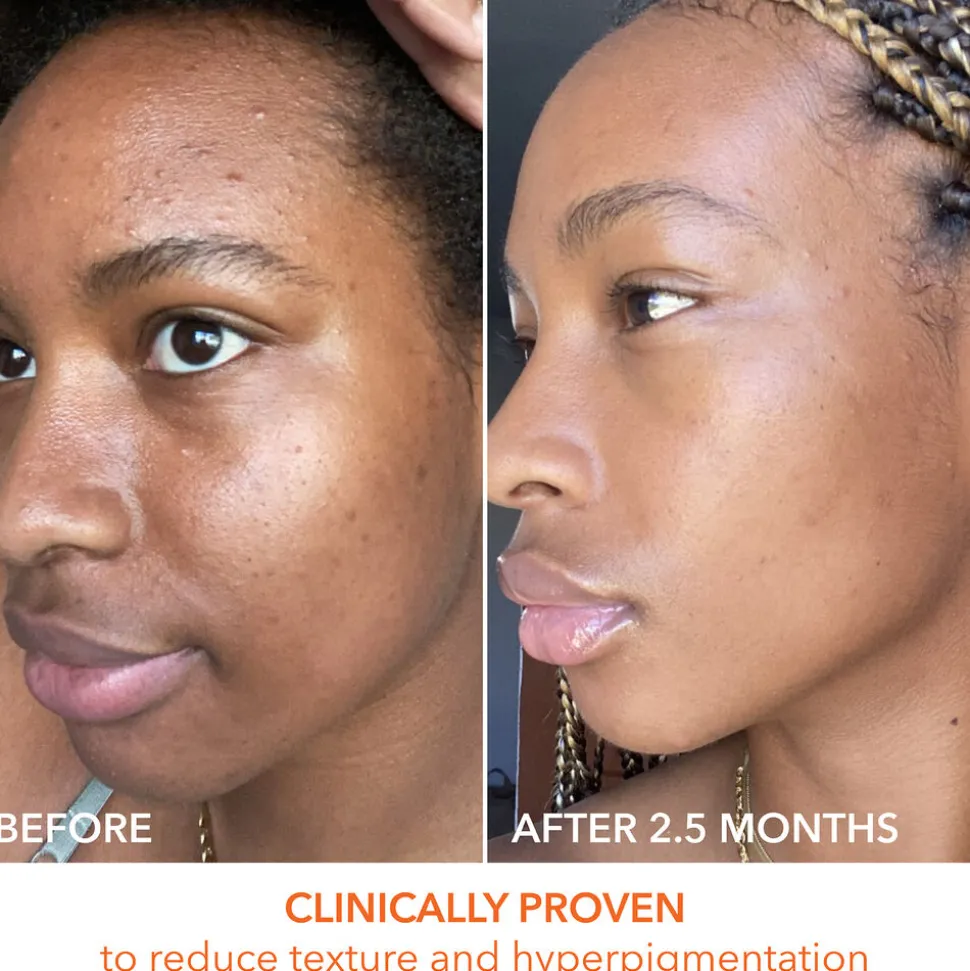 Alpha Beta Universal Daily Peel