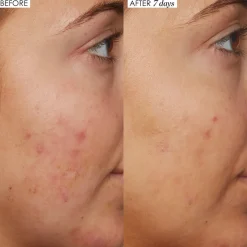 B3 Nice 10% Niacinamide Serum 30ML