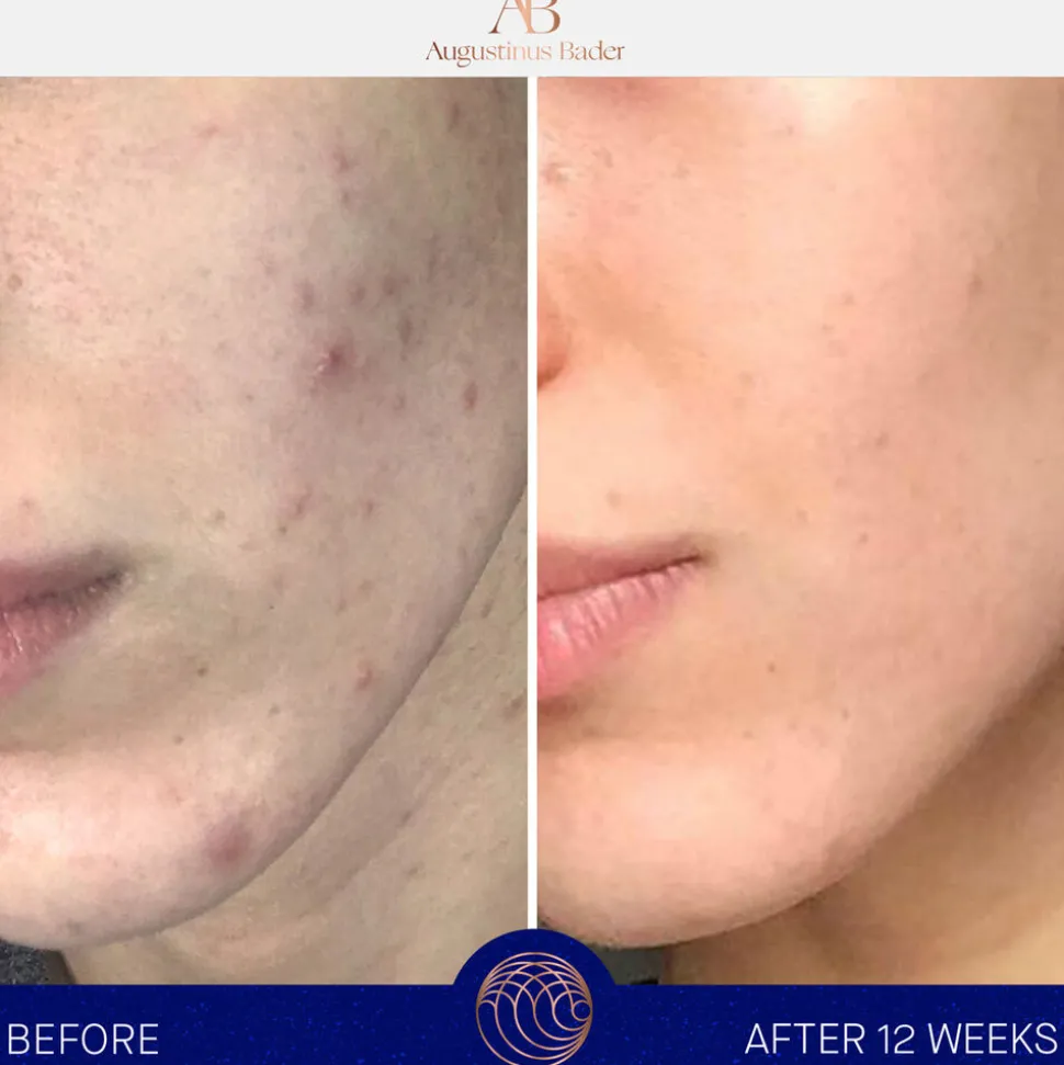 Complete Instant Recovery Serum 25ML
