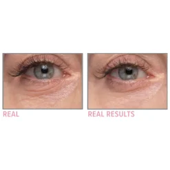 Confidence in An Eye Cream 15ML