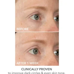 DermInfusions Lift + Repair Eye Mask