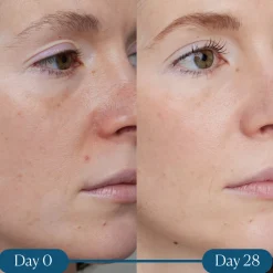 Dynamic Resurfacing Super-C Serum 30ML