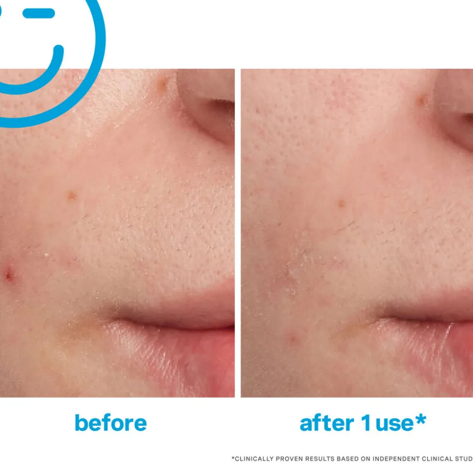 EradiKate Blemish Spot Treatment 30ML