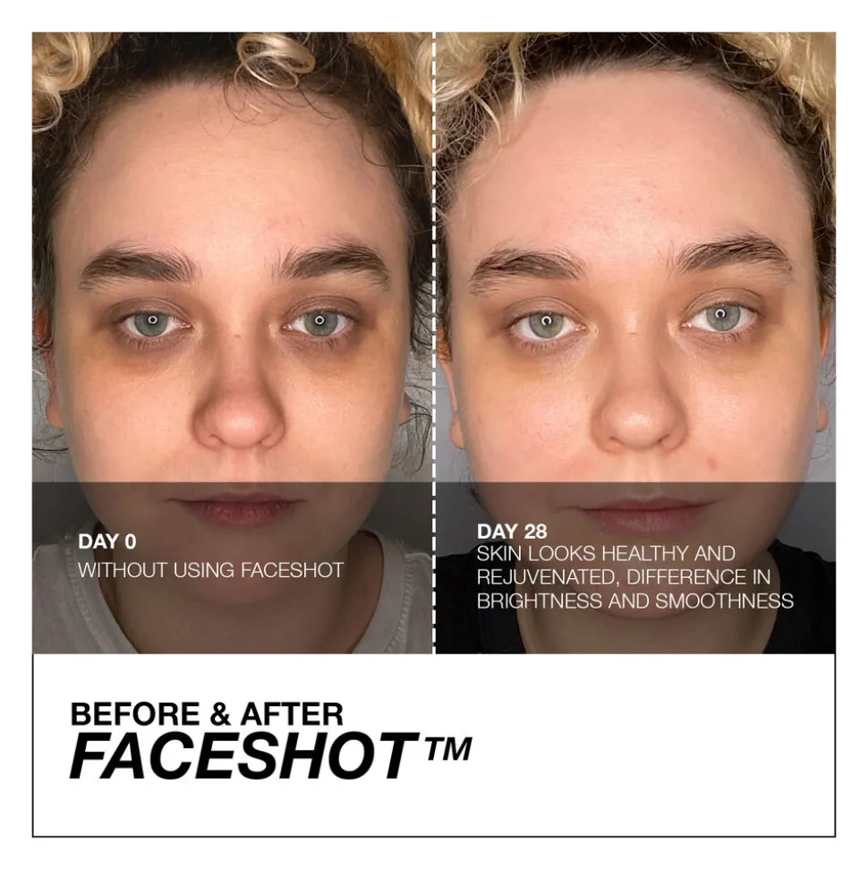 Faceshot Microneedling Device