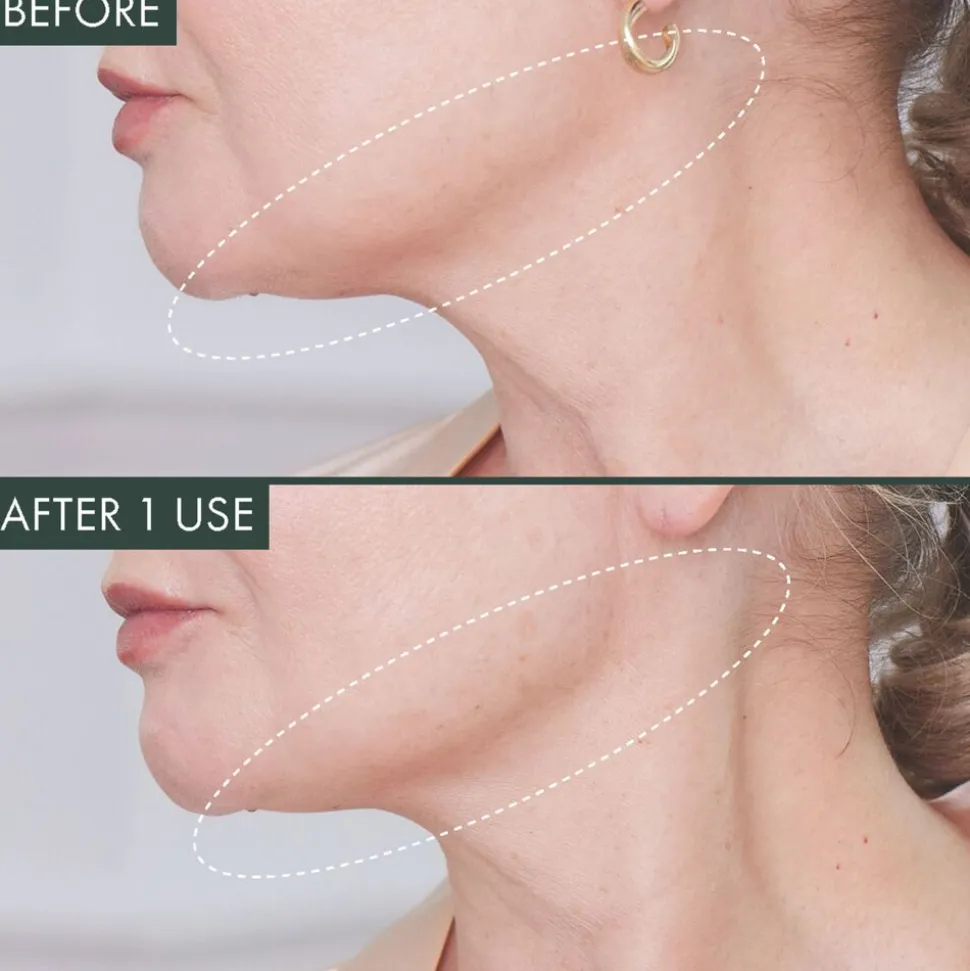 Fermitif Chin Contour Mask Instant Tightening Peptide Mask