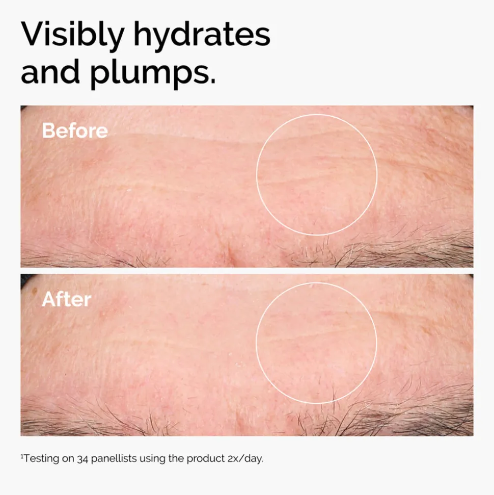 Hyaluronic Acid 2% + B5 30ML