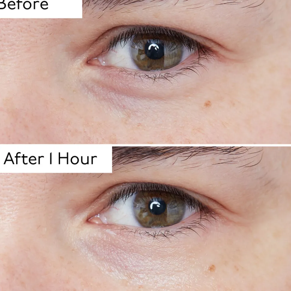 Hyaluronic Global Eye Serum