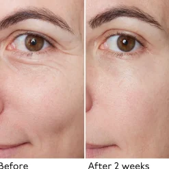 Hyaluronic Global Serum