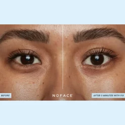 IonPlex® Hydra-Gel Power Patches