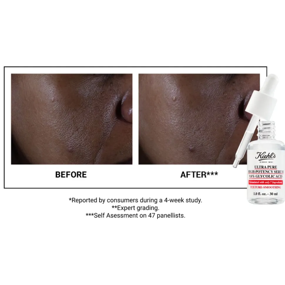 Kiehl's Ultra Pure High-Potency Serum 9.8% Glycolic Acid 30ML