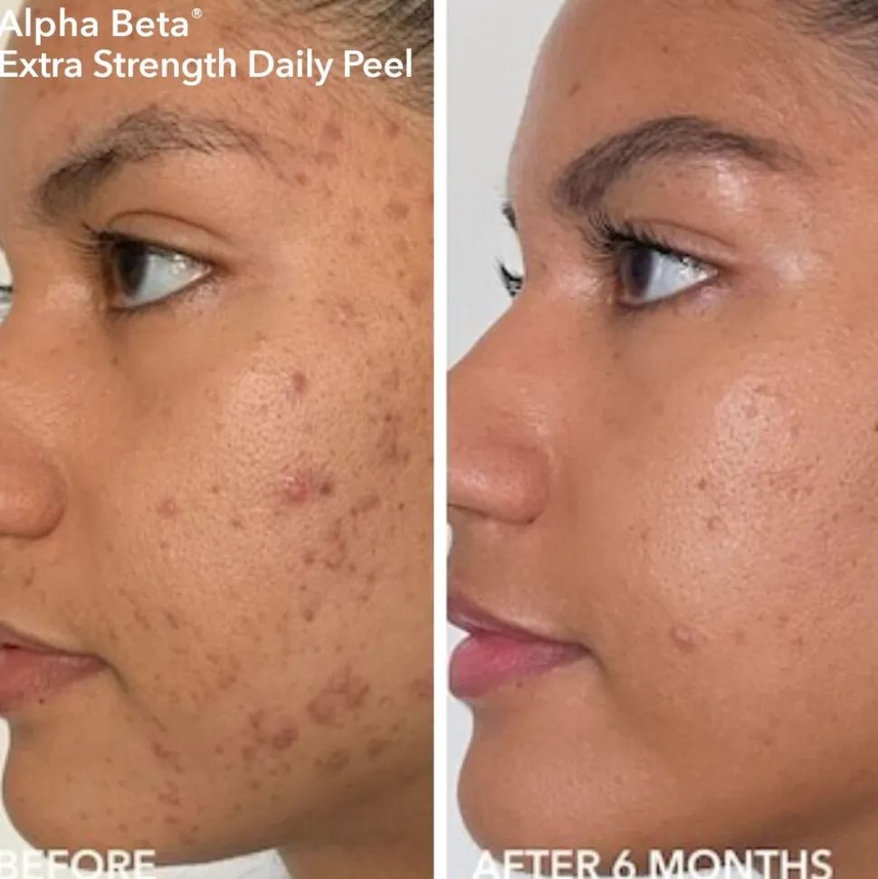 Limited Edition Spring Kit: Alpha Beta® Smooth, Radiant, Firm For Normal/Oily Skin