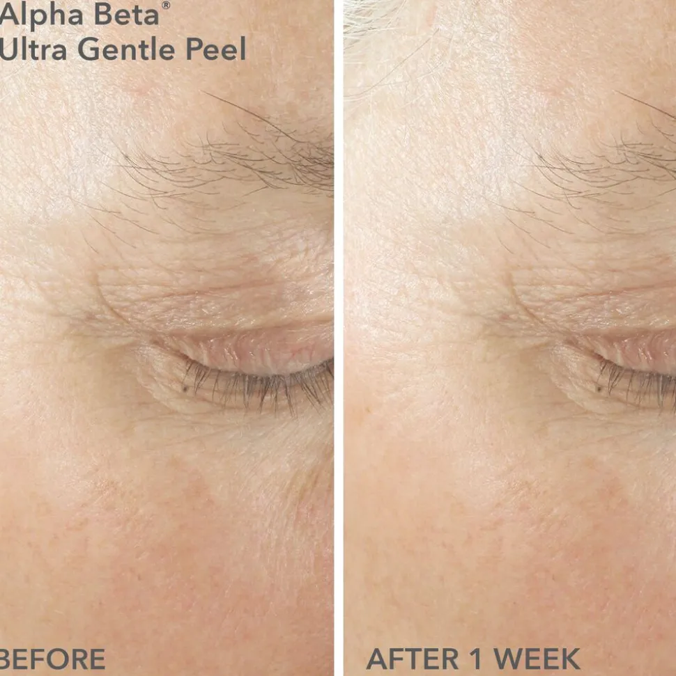 Limited Edition Spring Kit: Alpha Beta® Smooth, Radiant, Firm For Sensitive/Normal Skin