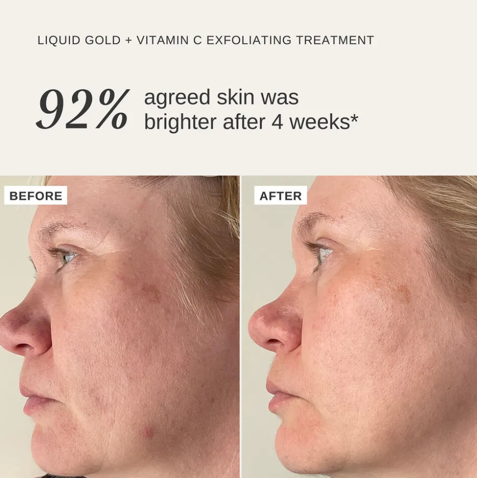 Liquid Gold + Vitamin C 100ML