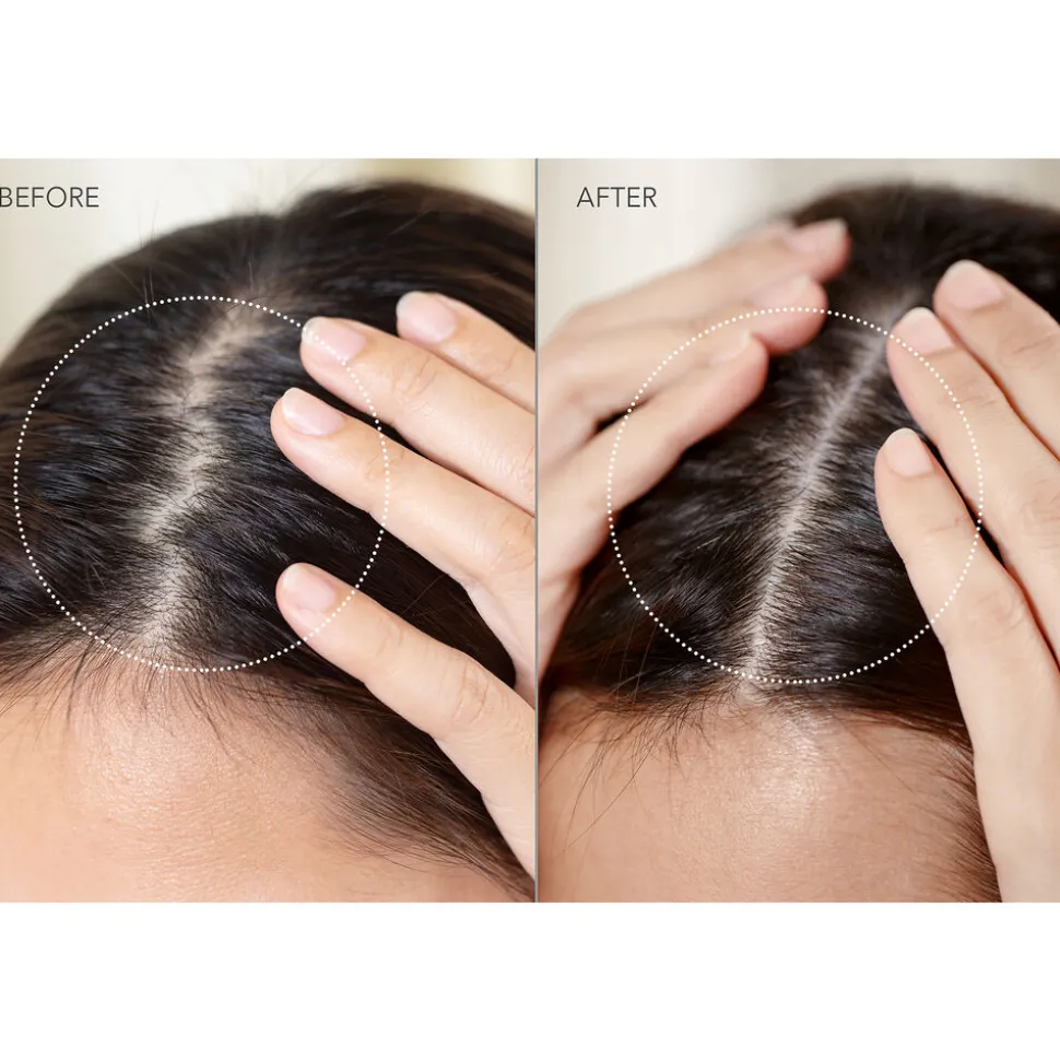 Luna™ 4 Hair