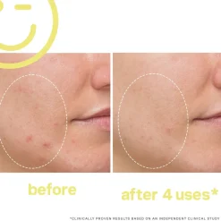 Mega-C™ 30% Vitamin C Brightening Facial 60ML