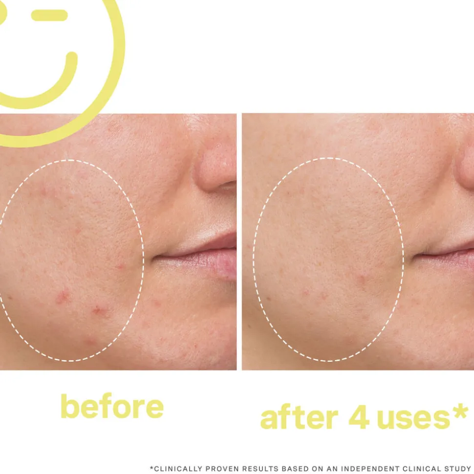 Mega-C™ 30% Vitamin C Brightening Facial 60ML