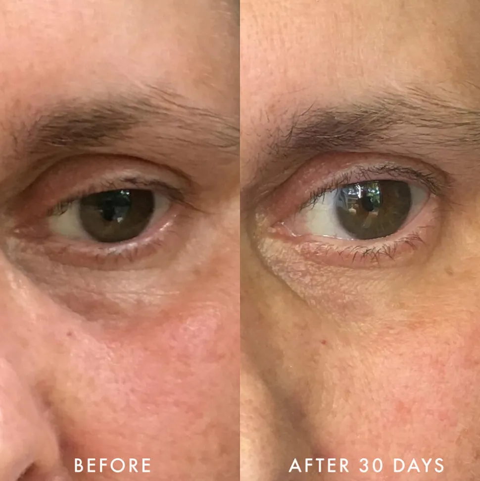 Niacinamide & Caffeine Eye Bright Cream 15G
