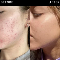 Niacinamide Serum 30ML
