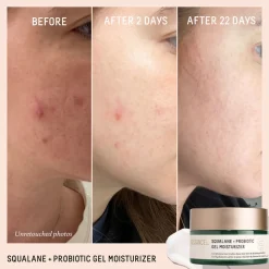 Probiotic Gel Moisturizer 50ML