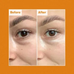 Radiance Brightening Dark Circle Eye Cream 15ML