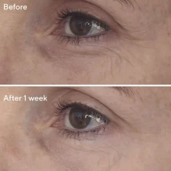 Retinal ReSculpt™ Eye Treatment 15ML