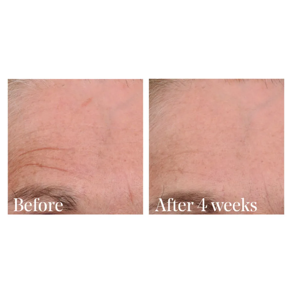 Retinal ReSculpt Overnight Treatment 30ML