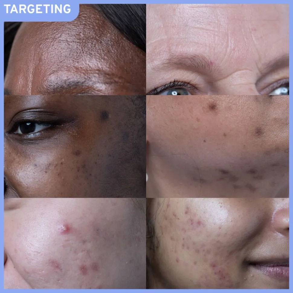 Retinoid 1 - Vitamin A Face Serum 30ML