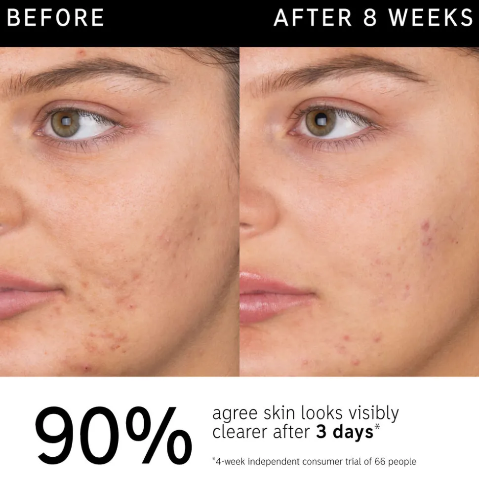 Salicylic Acid Cleanser 150ML
