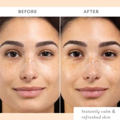 Skin Remedy Calm & Protect Mist 140G
