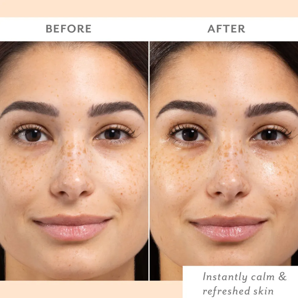 Skin Remedy Calm & Protect Mist 140G