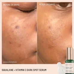 Squalane + Vitamin C Dark Spot Serum 30ML