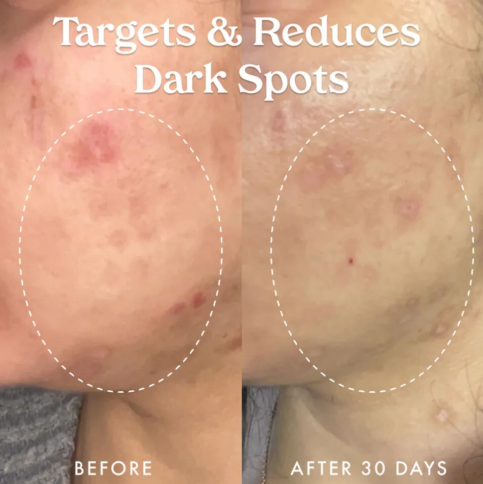 Star Bright Vitamin C Discolouration Correcting Serum 30ML