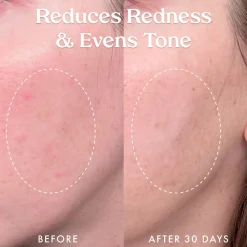 Star Bright Vitamin C Discolouration Correcting Serum 30ML