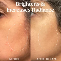 Star Bright Vitamin C Discolouration Correcting Serum 30ML