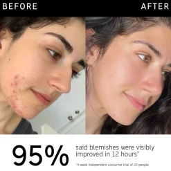 Succinic Acid Treatment 15ML