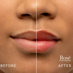 Sugar Lip Treatment
