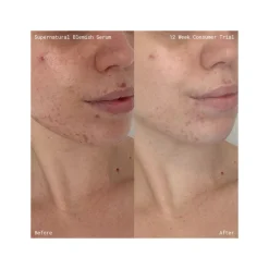Supernatural Blemish Face Serum Refill 60ML