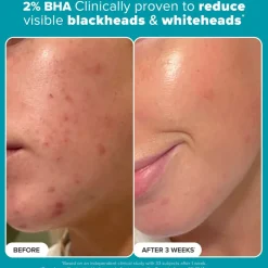 The Resurface & Hydrate Set
